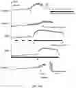 Fig. 19 - Peripheral neuromodulation to treat bladder and bowel dysfunction