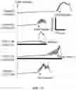 Fig. 25 - Peripheral neuromodulation to treat bladder and bowel dysfunction