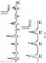 Fig. 32 - Peripheral neuromodulation to treat bladder and bowel dysfunction