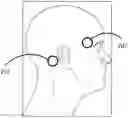 Fig. 01 - Apparatuses and methods for transdermal electrical stimulation of nerves to modify or induce a cognitive state