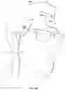 Fig. 07 - Apparatuses and methods for transdermal electrical stimulation of nerves to modify or induce a cognitive state