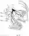 Fig. 30 - Apparatuses and methods for transdermal electrical stimulation of nerves to modify or induce a cognitive state