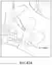 Fig. 48 - Apparatuses and methods for transdermal electrical stimulation of nerves to modify or induce a cognitive state