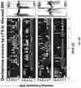 Fig. 09 - METHOD, DEVICE AND SYSTEM FOR SIMULATING AND/OR DELIVERING DEEP BRAIN STIMULATION