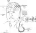 Fig. 01 - DEEP BRAIN STIMULATION SYSTEM WITH AMPLITUDE-MODULATED TEMPORAL PATTERNS