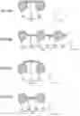 Fig. 07 - LASER WELDING DEVICE AND LASER WELDING METHOD