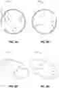 Fig. 06 - Socket devices and methods of use