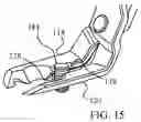 Fig. 06 - Plastic clip popper pliers and method of use
