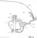 Fig. 04 - Removable door surround for a folding soft top