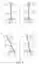 Fig. 05 - Lighting assembly for vehicle