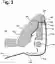 Fig. 06 - Vehicle upper seat portion with far side airbag module
