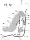 Fig. 08 - Vehicle upper seat portion with far side airbag module