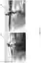 Fig. 25 - WAKE ENHANCING BOAT HULL
