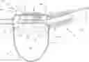 Fig. 01 - Fluid dispensing device