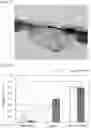 Fig. 05 - CALCIUM CARBONATE SINTERED BODY AND METHOD FOR PRODUCING SAME, AND BONE GRAFTING MATERIAL