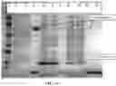 Fig. 45 - Recombinant proteins and their therapeutic uses