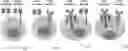 Fig. 01 - LILRB1-based chimeric antigen receptor
