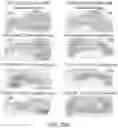 Fig. 48 - LILRB1-based chimeric antigen receptor