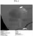 Fig. 04 - BIODEGRADABLE RESIN PARTICLES, BIODEGRADABLE RESIN PARTICLE GROUP INCLUDING THE PARTICLES, AND USE THEREOF