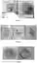 Fig. 03 - A BIOINK FOR 3D PRINTING, THE PREPARATION METHOD AND USAGE