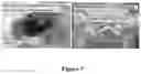 Fig. 04 - A BIOINK FOR 3D PRINTING, THE PREPARATION METHOD AND USAGE