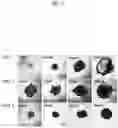 Fig. 03 - METHOD OF PRODUCING PLACENTA-LIKE ORGANOID, PLACENTA-LIKE ORGANOID, AND PRODUCTION OR TEST KIT