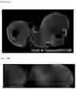 Fig. 15 - BRAIN ORGANOID MANUFACTURING METHOD