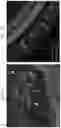 Fig. 30 - RPE cell populations and methods of generating same