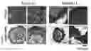 Fig. 12 - Culture Method for Head and Neck Organoids