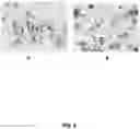Fig. 05 - METHODS FOR ENGINEERING HUMAN PLURIPOTENT STEM CELLS FOR DIABETES THERAPY BY CO-TRANSDUCTION