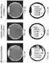 Fig. 04 - ISOLATED POLYNUCLEOTIDES AND POLYPEPTIDES, AND METHODS OF USING SAME FOR INCREASING PLANT YIELD AND/OR AGRICULTURAL CHARACTERISTICS