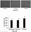 Fig. 20 - Gene Regulating Seed Weight in Improving Seed Yield in Soybean