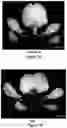 Fig. 24 - Gene Regulating Seed Weight in Improving Seed Yield in Soybean