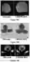 Fig. 28 - Gene Regulating Seed Weight in Improving Seed Yield in Soybean