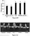 Fig. 34 - Gene Regulating Seed Weight in Improving Seed Yield in Soybean