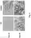 Fig. 05 - CONSTRUCTS AND METHODS FOR DELIVERING MOLECULES VIA VIRAL VECTORS WITH BLUNTED INNATE IMMUNE RESPONSES