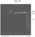 Fig. 31 - Mutant pore