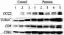 Fig. 01 - MARKER COMPOSITION FOR DIAGNOSING CANCER OR PREDICTING PROGNOSIS ON BASIS OF EXOSOME OVEREXPRESSING TUBA1C PROTEIN