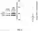Fig. 04 - MARKER COMPOSITION FOR DIAGNOSING CANCER OR PREDICTING PROGNOSIS ON BASIS OF EXOSOME OVEREXPRESSING TUBA1C PROTEIN