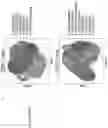 Fig. 15 - DETERMINATION OF CYTOTOXIC GENE SIGNATURE AND ASSOCIATED SYSTEMS AND METHODS FOR RESPONSE PREDICTION AND TREATMENT