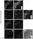 Fig. 22 - DETERMINATION OF CYTOTOXIC GENE SIGNATURE AND ASSOCIATED SYSTEMS AND METHODS FOR RESPONSE PREDICTION AND TREATMENT