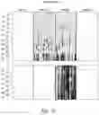 Fig. 13 - METHODS AND NUCLEIC ACIDS FOR ANALYSES OF CELLULAR PROLIFERATIVE DISORDERS