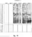 Fig. 30 - METHODS AND NUCLEIC ACIDS FOR ANALYSES OF CELLULAR PROLIFERATIVE DISORDERS