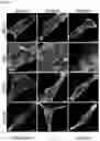Fig. 06 - Methods of diagnosing, determining the progression of, and treating a prostate cancer