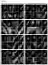 Fig. 07 - Methods of diagnosing, determining the progression of, and treating a prostate cancer