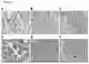 Fig. 10 - Methods of diagnosing, determining the progression of, and treating a prostate cancer