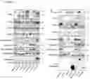 Fig. 12 - Methods of diagnosing, determining the progression of, and treating a prostate cancer