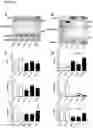 Fig. 33 - Methods of diagnosing, determining the progression of, and treating a prostate cancer