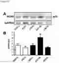 Fig. 46 - Methods of diagnosing, determining the progression of, and treating a prostate cancer