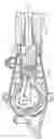 Fig. 05 - Pump fluid end with suction valve closure assist